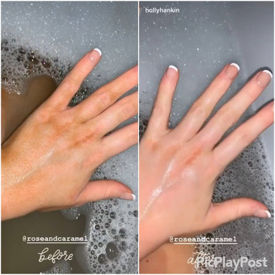Skin Saviours